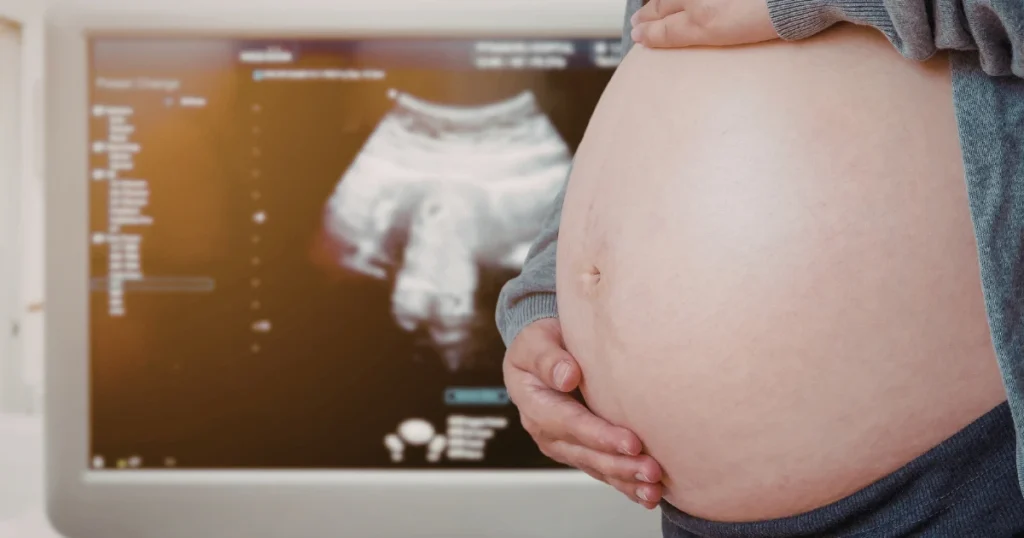 Control prenatal de alto riesgo y ultrasonido estructural en Matagalpa 1_1x