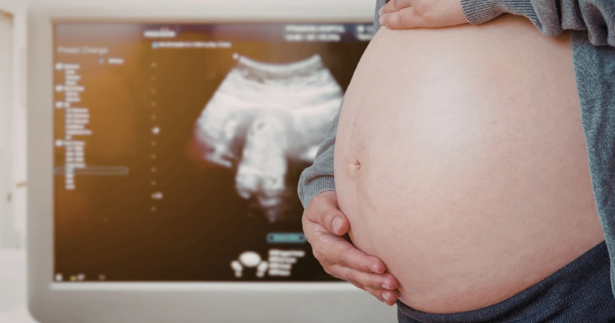 Control prenatal de alto riesgo y ultrasonido estructural en Matagalpa 1_1x